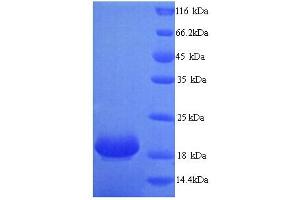 SDS-PAGE (SDS) image for LY6/PLAUR Domain Containing 6 (LYPD6) (AA 23-171) protein (His tag) (ABIN4974549) (LYPD6 Protein (AA 23-171) (His tag))