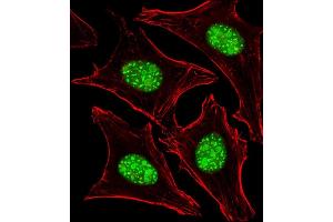 Immunofluorescent analysis of 4 % paraformaldehyde-fixed, 0. (Nucleostemin antibody  (N-Term))