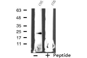 Western blot analysis of extracts from COS cells, using MRPL11 antibody.