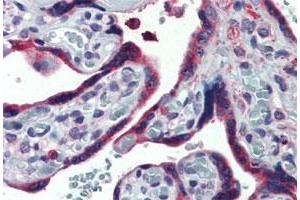 Immunohistochemistry (Formalin/PFA-fixed paraffin-embedded sections) of human placenta tissue with TXNDC4 polyclonal antibody . (ERP44 antibody  (Internal Region))