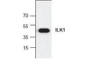 Image no. 1 for anti-Integrin-Linked Kinase (ILK) (C-Term) antibody (ABIN127105) (ILK antibody  (C-Term))