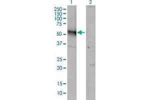 Western Blot analysis of AGT expression in transfected 293T cell line by AGT monoclonal antibody (M01), clone 1A10. (AGT antibody  (AA 376-485))