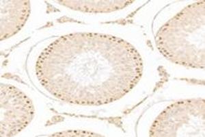 Immunohistochemistry analysis of paraffin-embedded rat testis using,ZCCHC7 (ABIN7076279) at dilution of 1: 3000 (ZCCHC7 antibody)