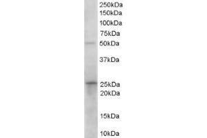 Image no. 1 for anti-Hydroxyprostaglandin Dehydrogenase 15-(NAD) (HPGD) (C-Term) antibody (ABIN374495) (HPGD antibody  (C-Term))