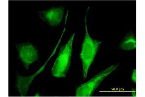 Immunofluorescence of monoclonal antibody to C6orf199 on HeLa cell. (AKD1 antibody  (AA 321-421))