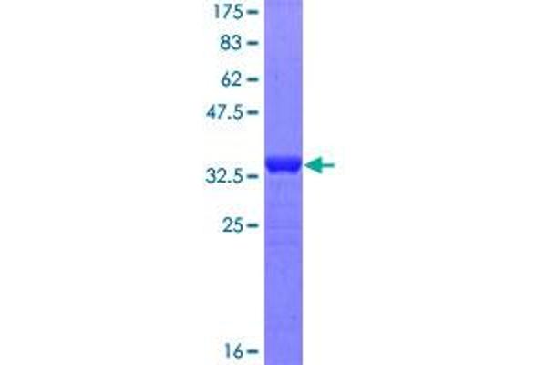MAP3K2 Protein (AA 111-200) (GST tag)