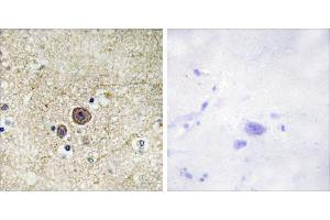 P-peptide - +Immunohistochemistry analysis of paraffin-embedded human brain tissue, using Catenin-α1 (Phospho-Ser641) antibody. (CTNNA1 antibody  (pSer641))
