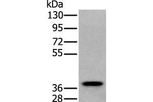 Western blot analysis of Human testis tissue lysate using ZPBP Polyclonal Antibody at dilution of 1:250