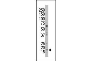 Image no. 1 for anti-Non-Metastatic Cells 1, Protein (NM23A) Expressed in (NME1) (N-Term) antibody (ABIN360544)