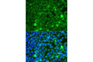 Immunofluorescence analysis of A549 cells using GBA3 antibody (ABIN5974945). (GBA3 antibody)