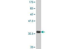 Western Blot detection against Immunogen (37. (USP21 antibody  (AA 466-565))