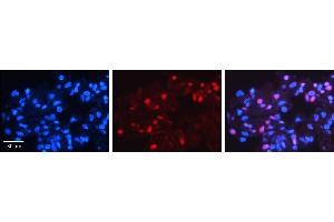 MXD4 antibody - N-terminal region          Formalin Fixed Paraffin Embedded Tissue:  Human Lung Tissue    Observed Staining:  Nucleus of pneumocytes   Primary Antibody Concentration:  1:100    Other Working Concentrations:  1/600    Secondary Antibody:  Donkey anti-Rabbit-Cy3    Secondary Antibody Concentration:  1:200    Magnification:  20X    Exposure Time:  0. (MXD4 antibody  (N-Term))
