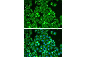 Immunofluorescence analysis of HeLa cells using STAT1 antibody (ABIN5998976). (STAT1 antibody)