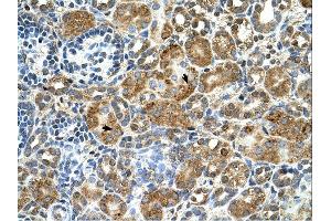 Cystatin B antibody was used for immunohistochemistry at a concentration of 4-8 ug/ml. (CSTB antibody)