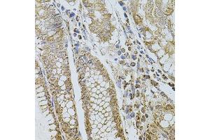 Immunohistochemistry of paraffin-embedded human stomach using CD62P/P-selectin antibody (ABIN6131514, ABIN6147503, ABIN6147506 and ABIN6218519) at dilution of 1:100 (40x lens).