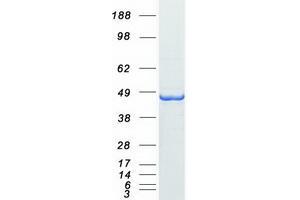 Validation with Western Blot (AMACR Protein (Transcript Variant 1) (Myc-DYKDDDDK Tag))