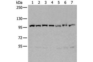 Western blot analysis of 231 Hela A549 A431 HEPG2 Jurkat and K562 cell lysates using VCP Polyclonal Antibody at dilution of 1:400
