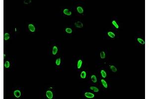 Immunofluorescent analysis of Hela cells using ABIN7139598 at dilution of 1:100 and Alexa Fluor 488-congugated AffiniPure Goat Anti-Rabbit IgG(H+L) (HIST1H3A antibody  (meLys36))