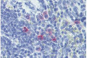 Rat spleen: Formalin-Fixed, Paraffin-Embedded (FFPE) (IL-13 antibody)
