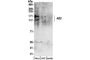 anti-Solute Carrier Family 4, Anion Exchanger, Member 2 (erythrocyte Membrane Protein Band 3-Like 1) (SLC4A2) (AA 275-325) antibody