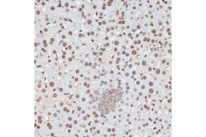 Immunohistochemistry (IHC) image for anti-Tumor Protein P53 (TP53) (pSer33) antibody (ABIN6136276)
