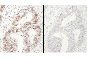 Immunohistochemistry (IHC) image for anti-Minichromosome Maintenance Complex Component 2 (MCM2) (pSer40), (pSer41) antibody (ABIN7448650)