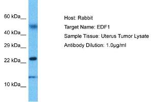 Host: Rabbit Target Name: EDF1 Sample Type: Uterus Tumor lysates Antibody Dilution: 1. (EDF1 antibody  (N-Term))