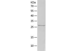 Western Blotting (WB) image for Colony Stimulating Factor 3 (Granulocyte) (CSF3) (AA 31-208) protein (His tag) (ABIN7122462) (G-CSF Protein (AA 31-208) (His tag))