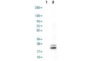 Western Blot analysis of Lane 1: negative control (vector only transfected HEK293T cell lysate) and Lane 2: over-expression lysate (co-expressed with a C-terminal myc-DDK tag in mammalian HEK293T cells) with RNASE7 monoclonal antibody, clone CL0224 .
