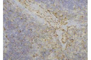 ABIN6277719 at 1/100 staining Human lymph node tissue by IHC-P. (ADH6 antibody)