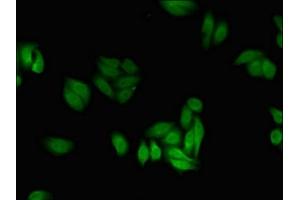 Immunofluorescent analysis of HepG2 cells using ABIN7142693 at dilution of 1:100 and Alexa Fluor 488-congugated AffiniPure Goat Anti-Rabbit IgG(H+L) (PFKFB2 antibody  (AA 360-505))