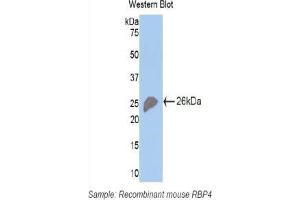 Western blot analysis of the recombinant protein. (RBP4 antibody  (AA 63-245))