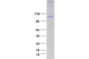 Validation with Western Blot (TRPC3 Protein (Transcript Variant 2, Trp3) (Myc-DYKDDDDK Tag))