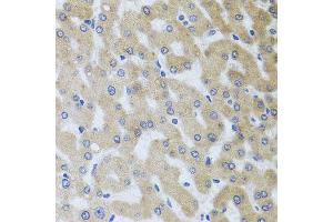 Immunohistochemistry of paraffin-embedded human liver injury using UVRAG antibody at dilution of 1:100 (x40 lens).