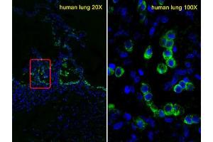 Immunofluorescence (IF) image for anti-Surfactant Protein C (SFTPC) antibody (ABIN2911136)