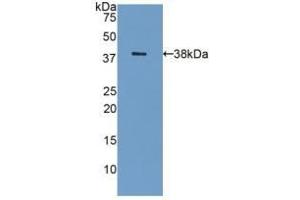 Detection of Recombinant GAL8, Human using Polyclonal Antibody to Galectin 8 (GAL8) (LGALS8 antibody  (AA 1-317))
