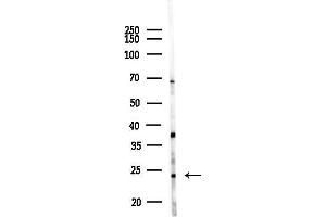Western blot analysis of lysates from Mouse liver, using WDYHV1 Antibody at 1/1000 dilution.