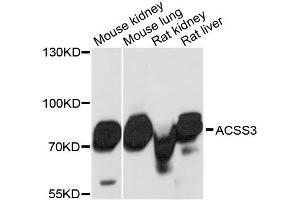 Western blot analysis of extracts of various cell lines, using ACSS3 antibody. (ACSS3 antibody)
