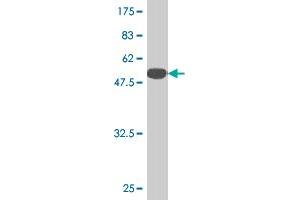 Western Blot detection against Immunogen (51. (TK1 antibody  (AA 1-234))