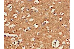 Immunohistochemistry of paraffin-embedded human brain tissue using ABIN7154490 at dilution of 1:100 (GAS7 antibody  (AA 1-153))