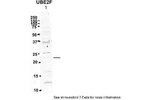 Sample Type: 1. (UBE2F antibody  (N-Term))