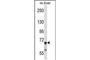 IL1R1 Antibody (C-term) (ABIN657915 and ABIN2846862) western blot analysis in mouse liver tissue lysates (35 μg/lane). (IL1R1 antibody  (C-Term))