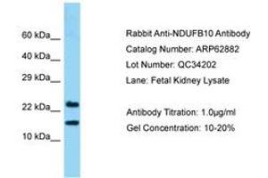 Image no. 1 for anti-NADH Dehydrogenase (Ubiquinone) 1 beta Subcomplex, 10, 22kDa (NDUFB10) (AA 91-140) antibody (ABIN6749956) (NDUFB10 antibody  (AA 91-140))