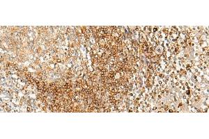 Immunohistochemistry of paraffin-embedded Human tonsil tissue using HLA-DPA1 Polyclonal Antibody at dilution of 1:35(x200) (HLA-DPA1 antibody)