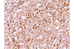 Immunohistochemical staining (Formalin-fixed paraffin-embedded sections) of human tonsil with CD79A recombinant monoclonal antibody, clone IGA/1688R . (Recombinant CD79a antibody  (AA 208-222))