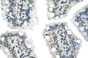 Image no. 1 for anti-GIPC PDZ Domain Containing Family, Member 2 (GIPC2) (N-Term) antibody (ABIN202222) (GIPC2 antibody  (N-Term))
