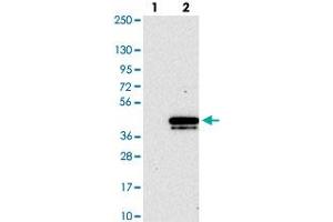 Western blot analysis of Lane 1: Negative control (vector only transfected HEK293T lysate). (CHMP4B antibody)