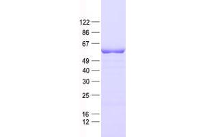 Validation with Western Blot (ADCK4 Protein (His tag))