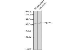 Western blot analysis of extracts of various cell lines, using VEGFA antibody. (VEGF antibody)