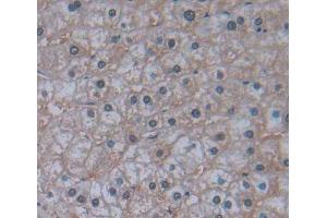 Used in DAB staining on fromalin fixed paraffin- embedded liver tissue (IRS4 antibody  (AA 1-196))